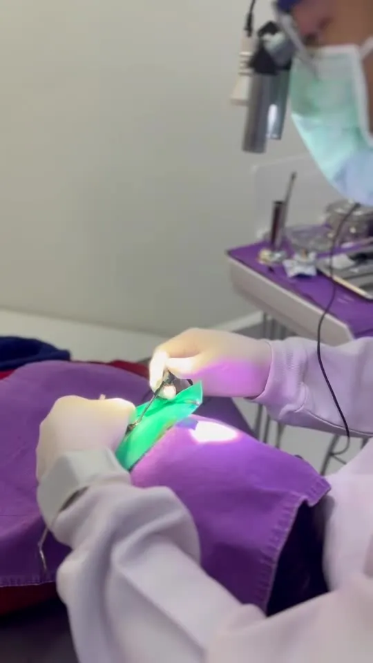 Root canal treatment under way with a rubber dam isolating the tooth